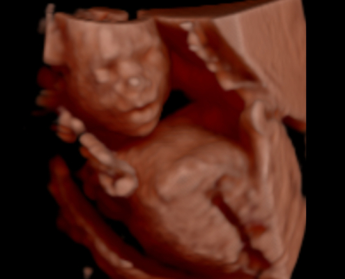 Ultrasound Photo