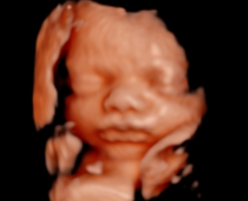 Ultrasound Photo