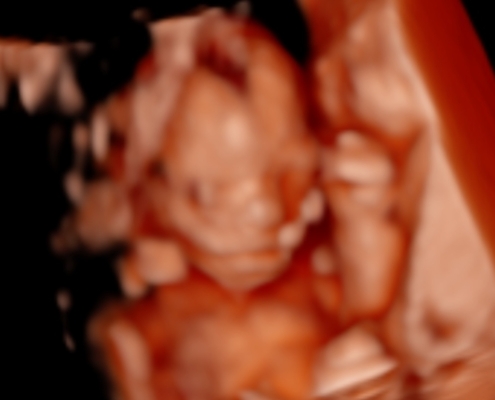 Ultrasound Photo