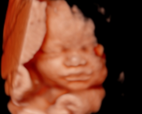 Ultrasound Photo