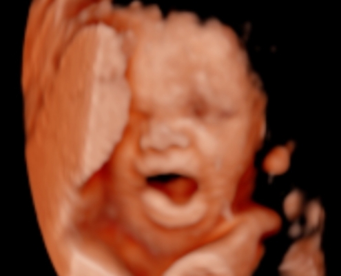 Ultrasound Photo